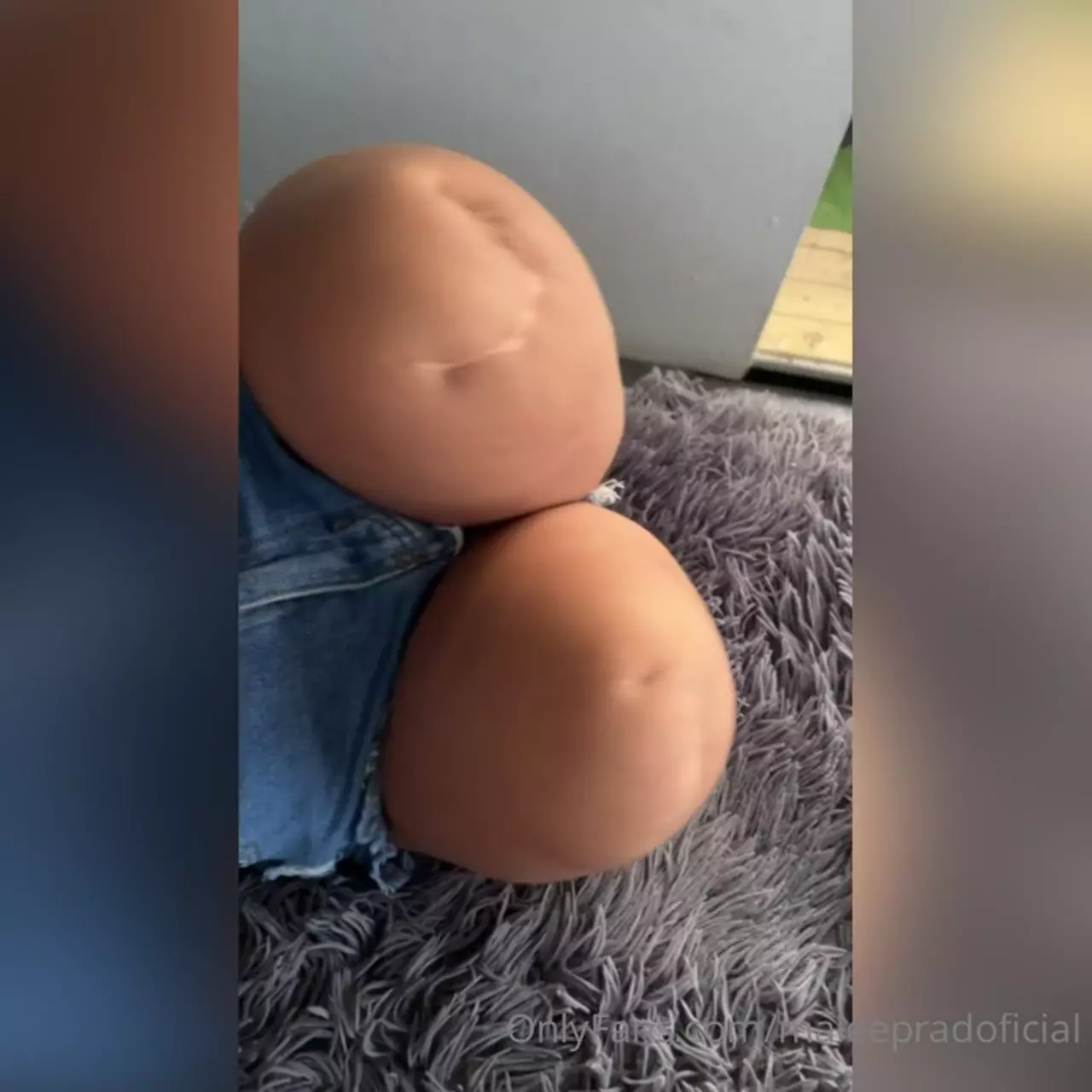 Malee Prado exibindo suas pernas que foram amputadas